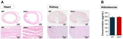 Ghrelin is essential for lowering blood pressure during torpor